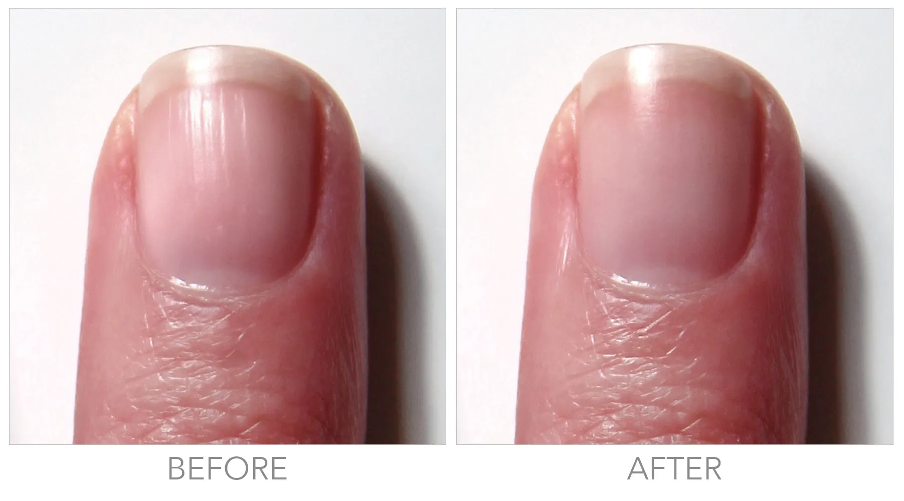 Fortifying Ridge Filler | Nail Care - Clean Beauty